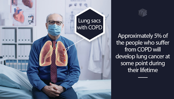 Having COPD Increases Your Risk of Lung Cancer | ELG Law