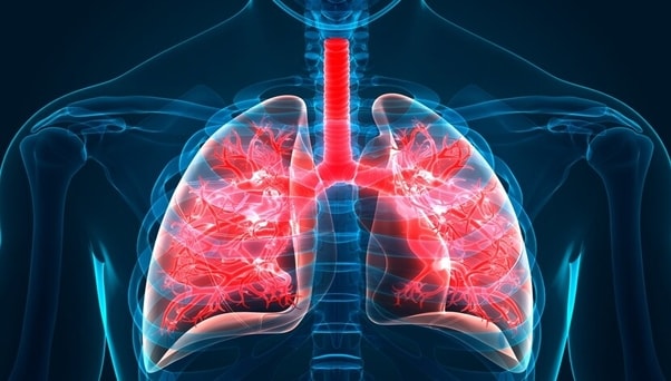 Pulmonary Fibrosis Increases the Risk of Contracting Coronavirus | ELG Law