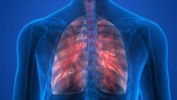 Restrictive Lung Diseases and Exposure to Asbestos | ELG Law