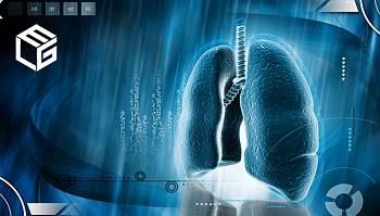 AI-based assessment tool used to track asbestos-related cancers