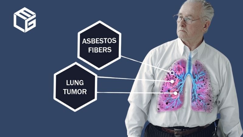 Asbestos Lung Cancer Claims | Asbestos Exposure | ELG Law