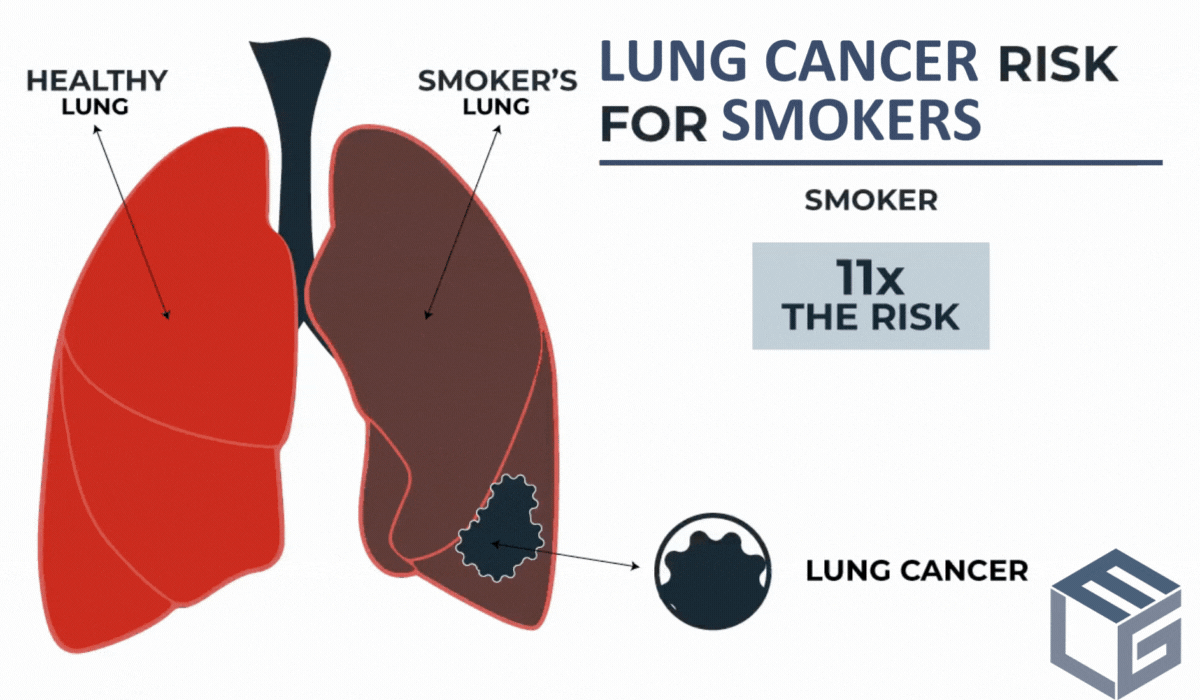 hypothesis about smoking and lung cancer