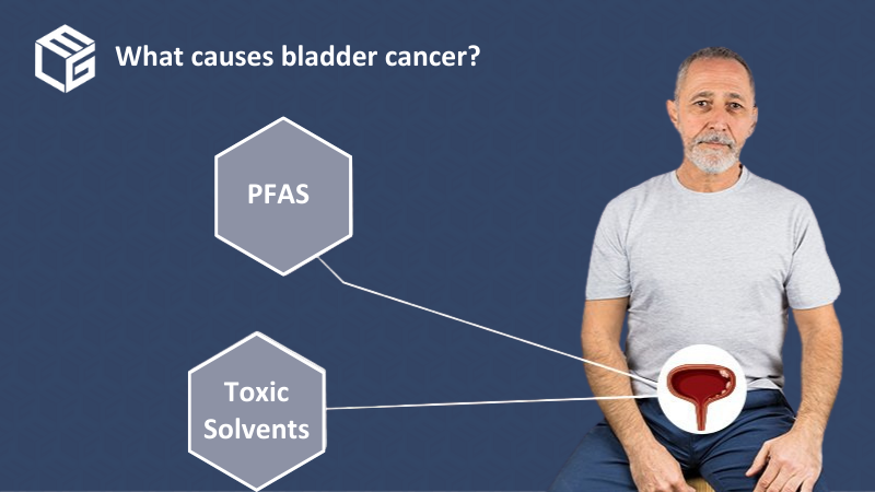 Bladder cancer  video