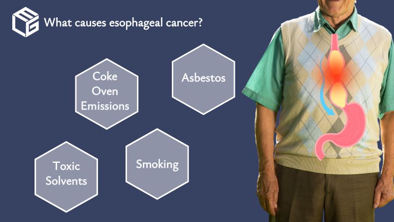 Esophageal cancer claims video