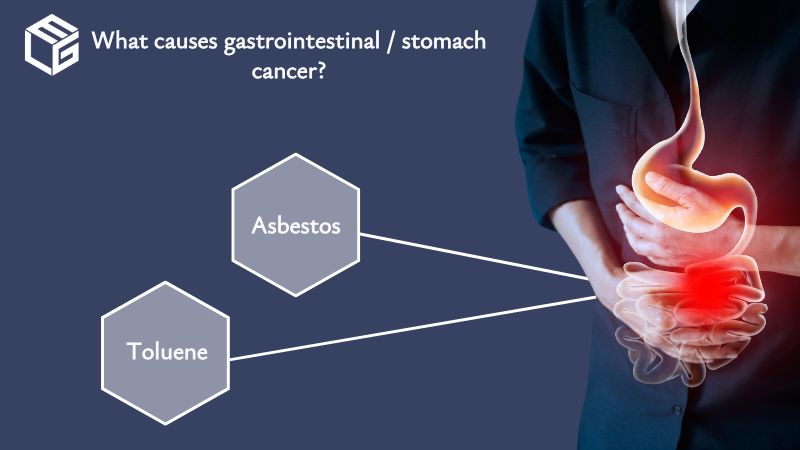 Gastrointestinal / stomach cancer video