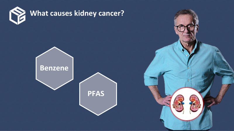 Kidney cancer claims video