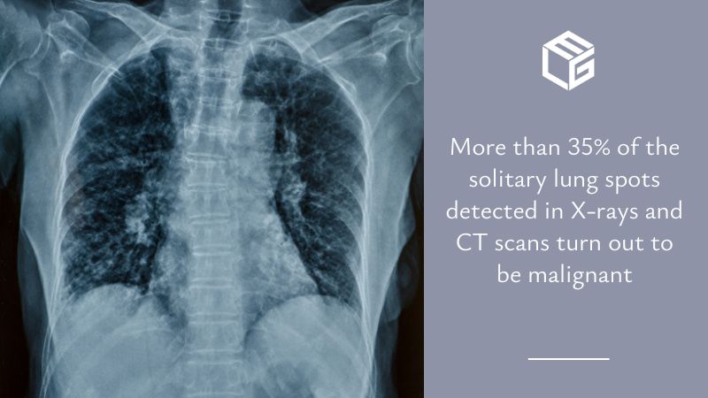  Lung spots  video