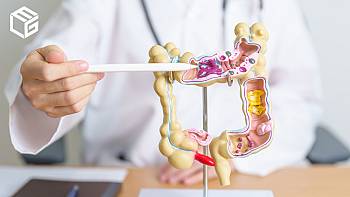 PFAS exposure has been linked to ulcerative colitis